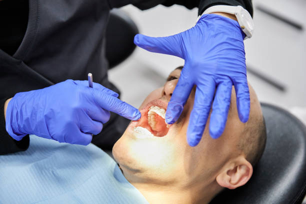 Best Emergency Dental Care for Broken or Chipped Teeth in Riverton, WY